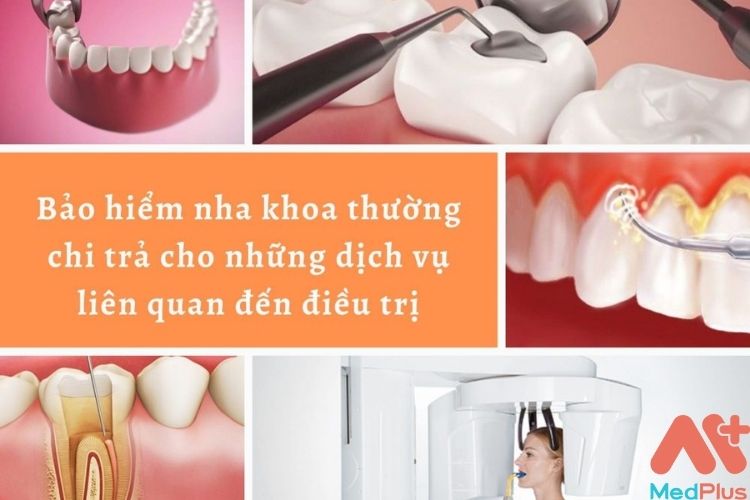 Làm thế nào để đảm bảo bạn nhận được số tiền xứng đáng từ bảo hiểm nha khoa của mình