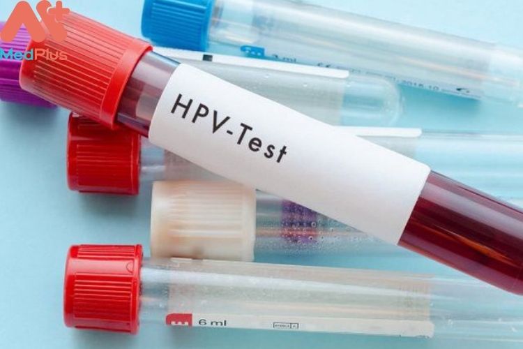 Xét nghiệm HPV