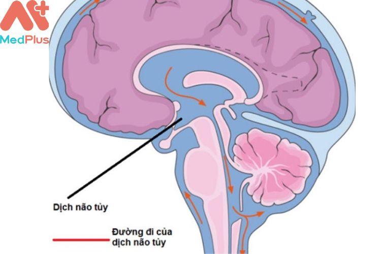 Dò dịch não tủy là gì?