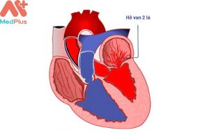 Hở van 2 lá mua bảo hiểm sức khỏe Bảo Việt An Gia có được không?