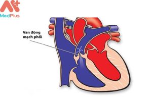 Hở van động mạch phổi mua bảo hiểm sức khỏe Bảo Việt An Gia và 4 điều cần biết