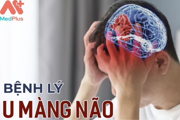 Nguyên nhân mắc bệnh u não?