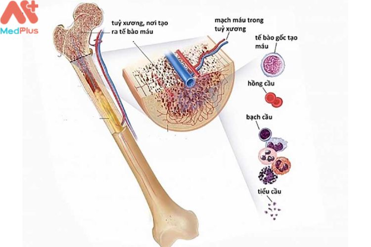 Suy tủy xương là gì?