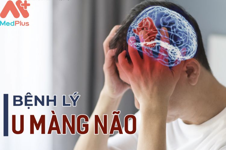 U mãng não mua bảo hiểm sức khỏe bảo việt an gia