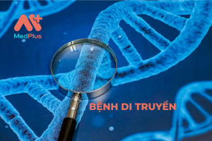 benh-di-truyen