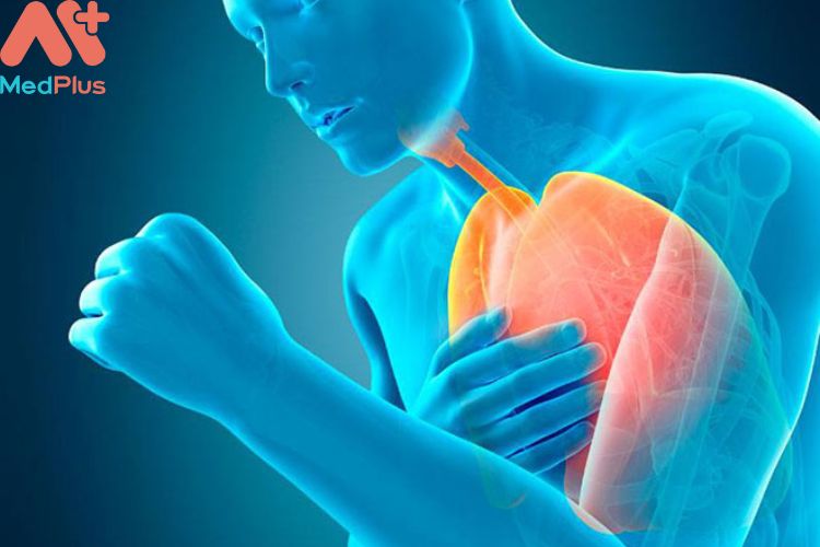 Khó thở là triệu chứng thường thấy ở bệnh rối loạn nhịp tim 