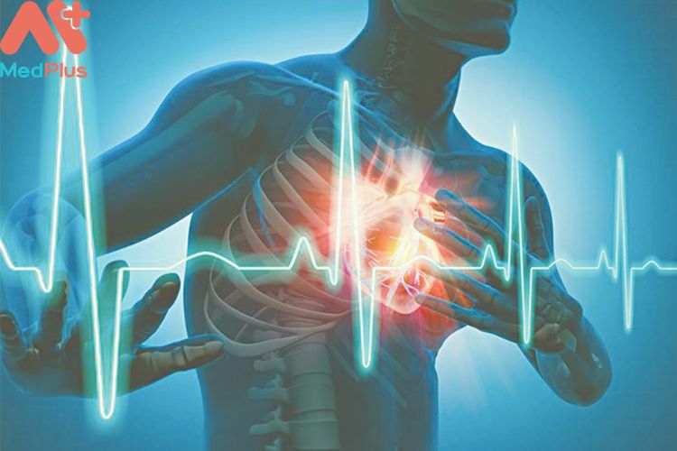 Rối loạn nhịp tim mua Bảo hiểm sức khỏe Bảo Việt An Gia 