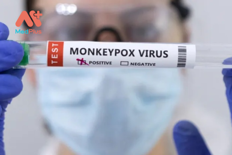 Một số biện pháp phòng ngừa bệnh virus đậu mùa khỉ